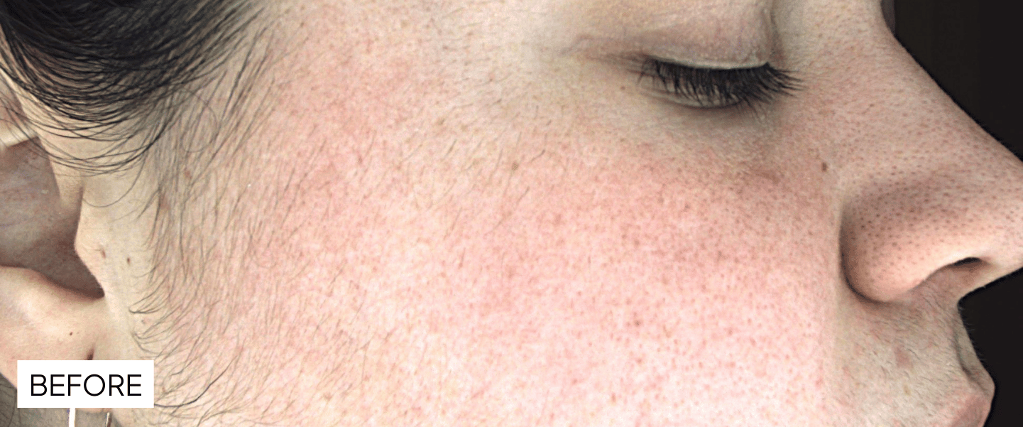 Before image